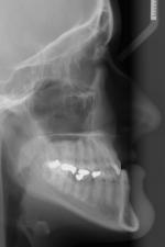 Ortodontick anomlie