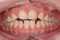 Ortodontické anomálie