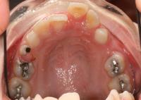 Ortodontické anomálie