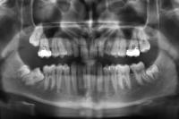 Ortodontick anomlie