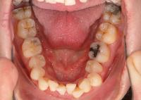 Ortodontick anomlie